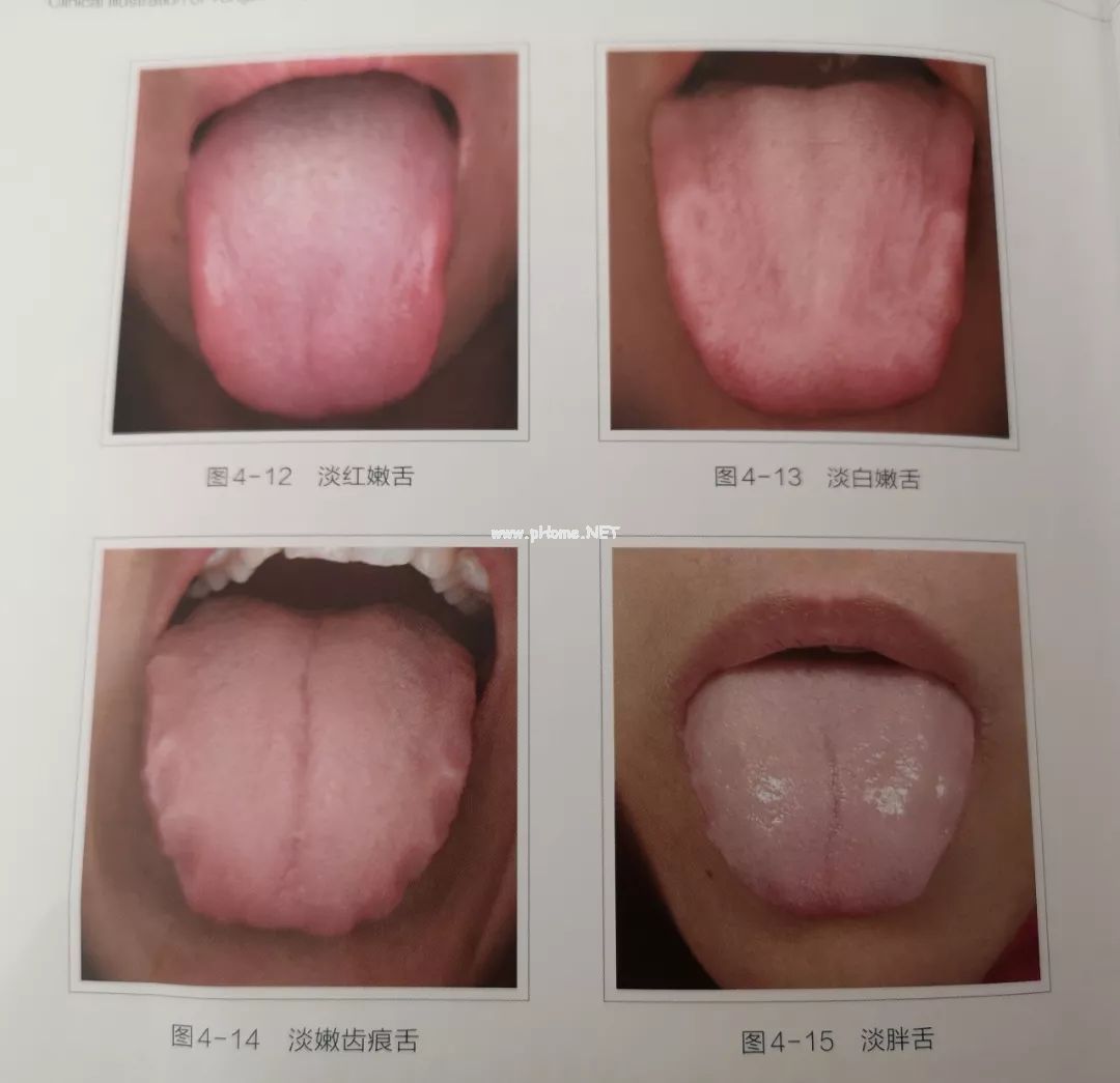 1分钟教你观舌术，附解决方法