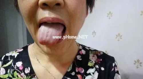 舌头一旦出现这个信号:重视一下。 舌头一旦出现这个信号:重视一下。