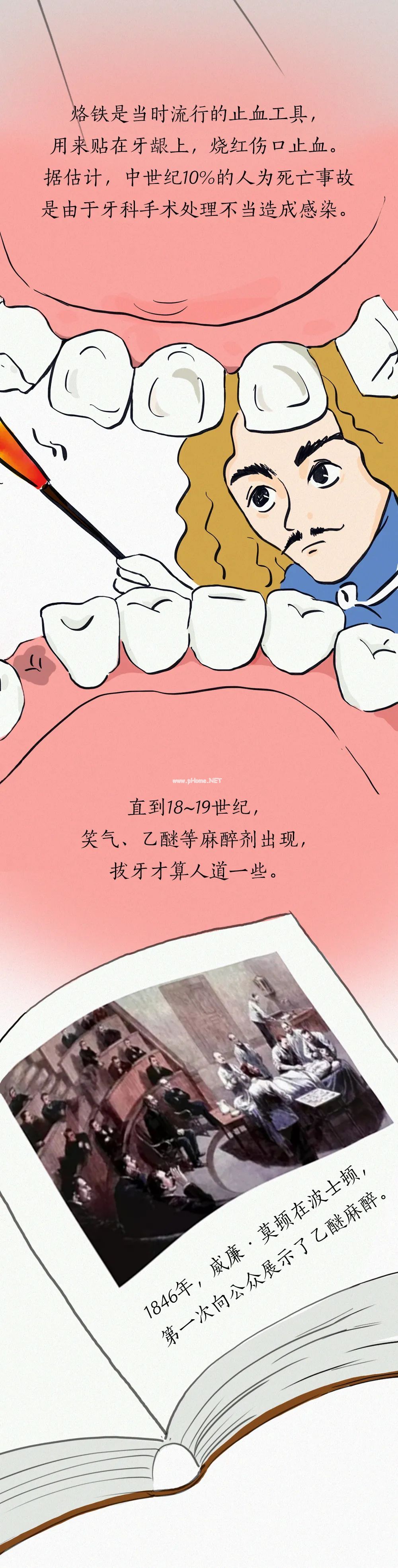人类「拔牙」趣味简史