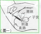 【每日一药】克霉唑栓（友南）