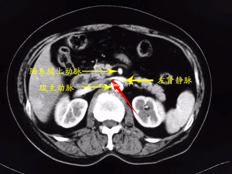 男孩出现皮疹、血尿……不注意这个细节，误诊几率大